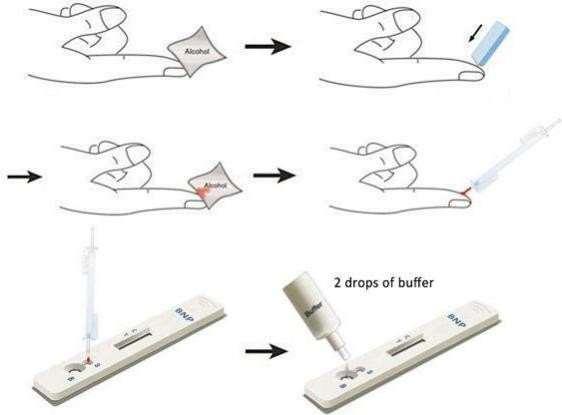 D-Dimer Rapid Test Device2